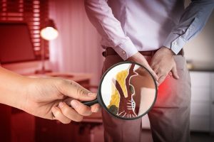 Cara Mencegah Penyakit Ambeien Dengan Strategi Proaktif Untuk Kesehatan Usus